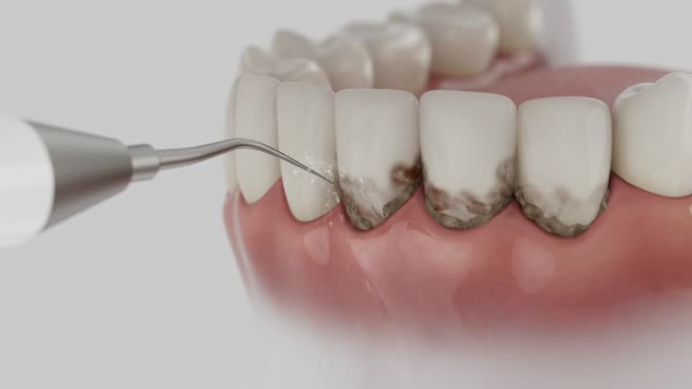Reliable Dental Implants contractor in Bolivar, MO by Smile Center Dentistry